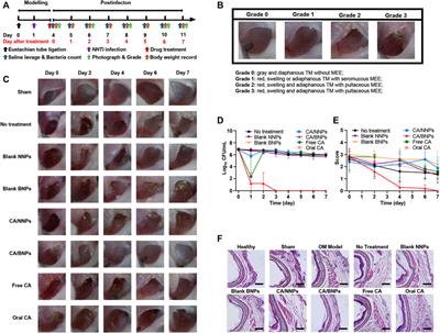 In Vivo Evaluation of Cefuroxime Axetil-Loaded Bioadhesive Nanoparticles to Treat Haemophilus influenzae-Induced Otitis Media